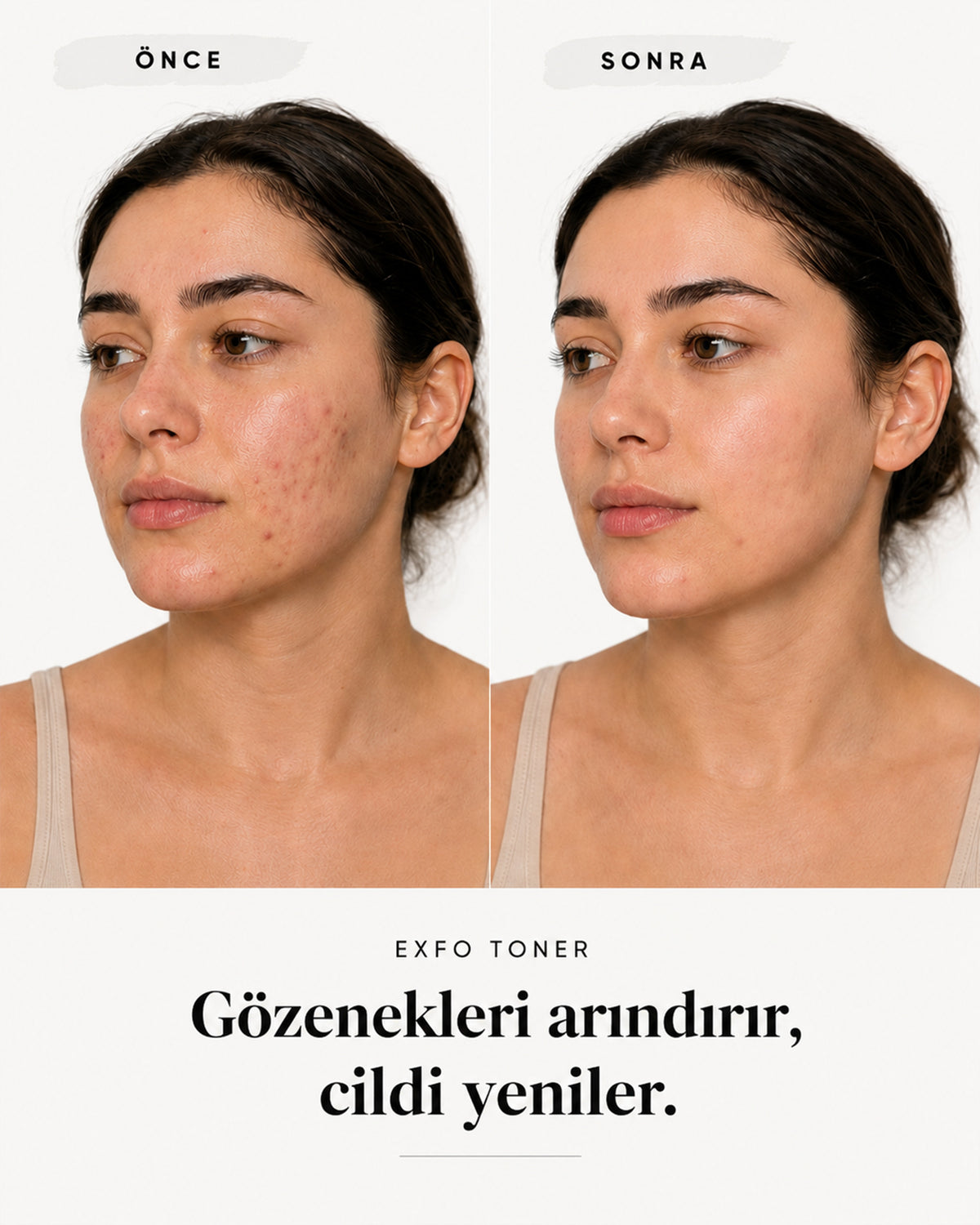 AHA BHA PHA EXFO TONER — görsel 6/6