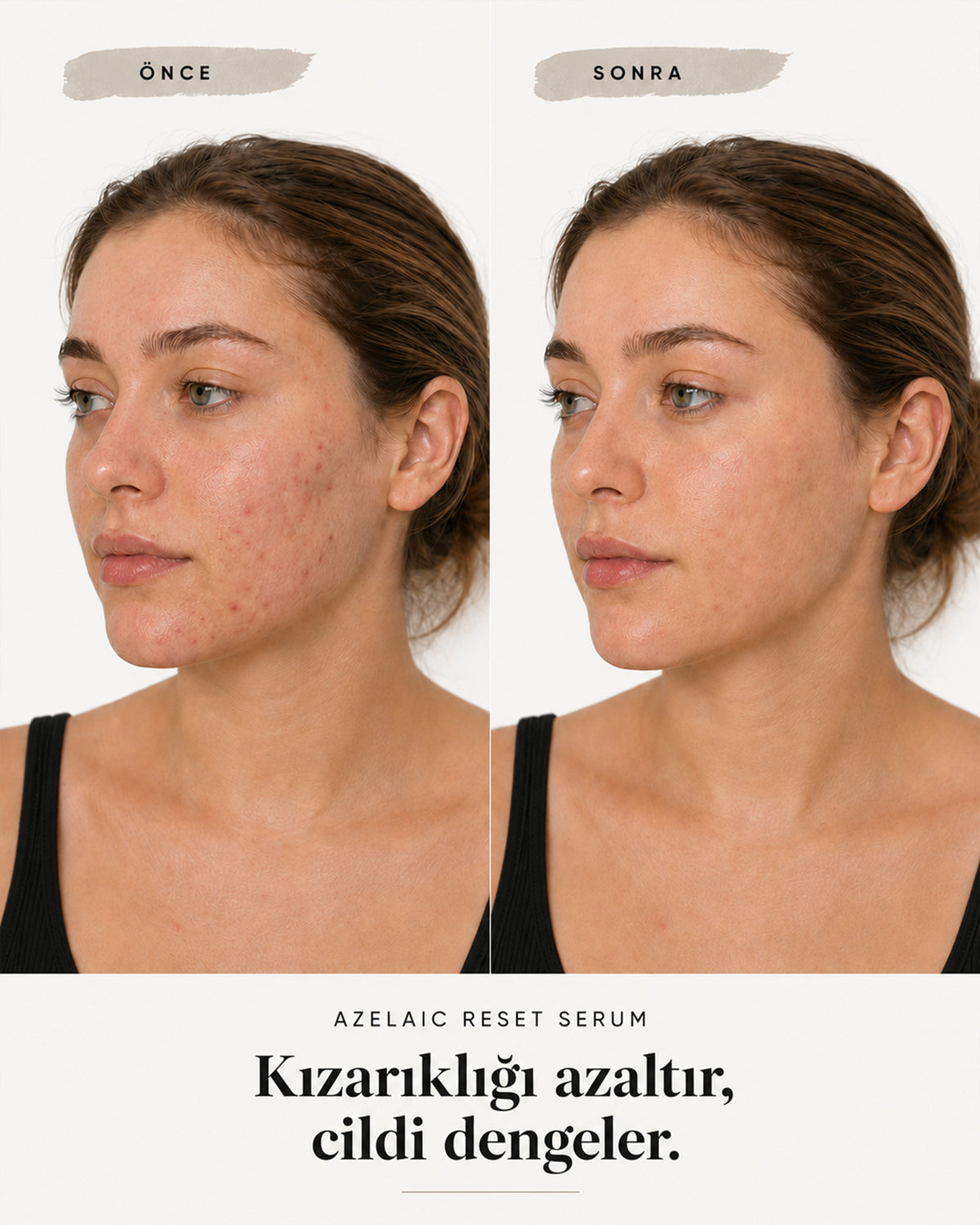 AZELAIC RESET SERUM — görsel 6/6